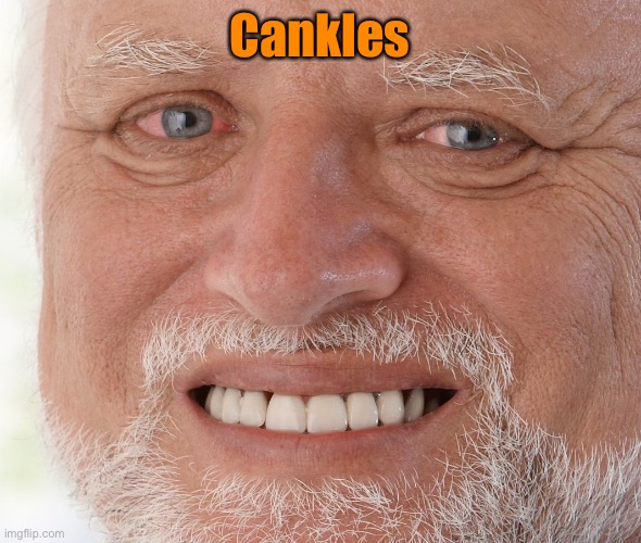 Hide the Pain Harold | Cankles | image tagged in hide the pain harold | made w/ Imgflip meme maker
