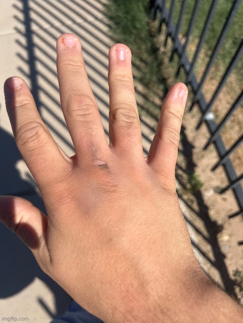 Hand post daily wall punching | made w/ Imgflip meme maker