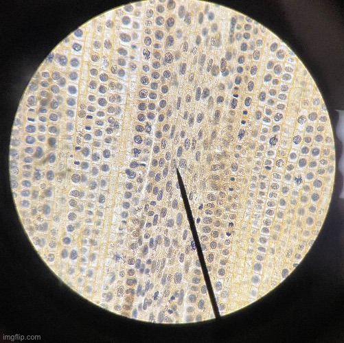 A picture of some cells under a microscope that I needed to take for a science project | image tagged in freshman,science,biology | made w/ Imgflip meme maker