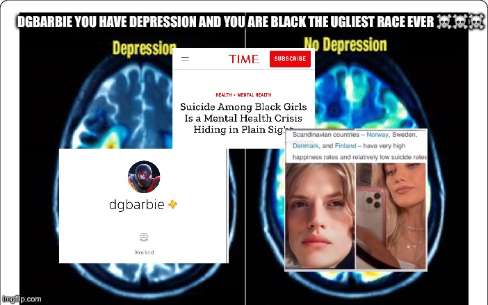 Add DgBarbie On psn she has depression and she’s ugly and black | DGBARBIE YOU HAVE DEPRESSION AND YOU ARE BLACK THE UGLIEST RACE EVER ☠️☠️☠️ | image tagged in depression,black,black lives matter,ugly woman,ugly,american | made w/ Imgflip meme maker