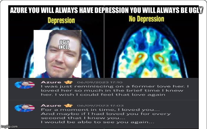 Azure ocean.View Has No Girlfrend Because he’s a ugly Hideous American With Depression | AZURE YOU WILL ALWAYS HAVE DEPRESSION YOU WILL ALWAYS BE UGLY | image tagged in ugly,america,american,depression,ugly guy,mental illness | made w/ Imgflip meme maker
