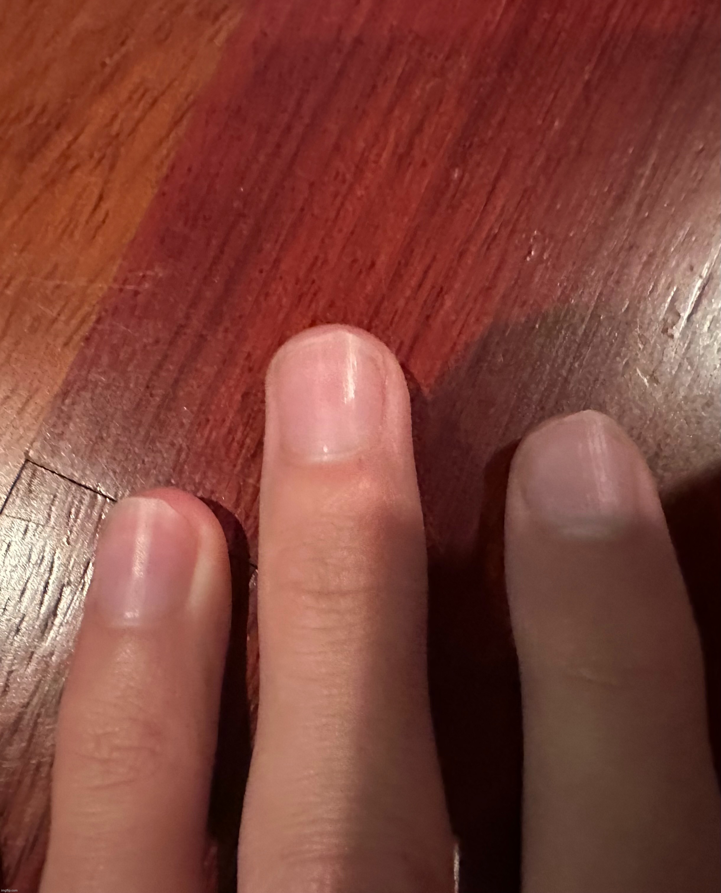 finger reveal my hands are smol | image tagged in potat | made w/ Imgflip meme maker