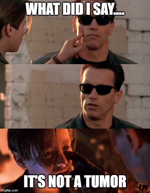 What is this? | WHAT DID I SAY.... IT'S NOT A TUMOR | image tagged in terminator 2 | made w/ Imgflip meme maker