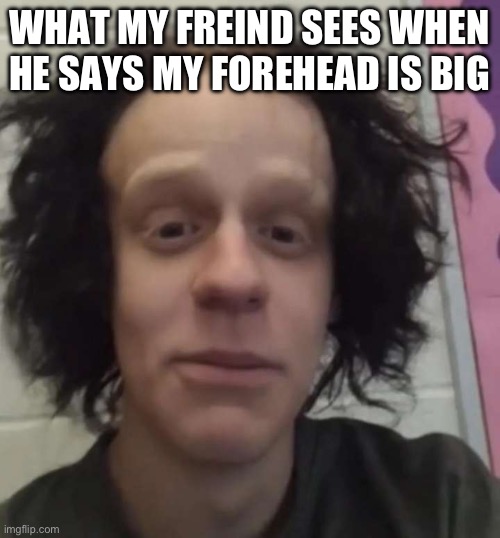 Big forehead | WHAT MY FREIND SEES WHEN HE SAYS MY FOREHEAD IS BIG | image tagged in forehead | made w/ Imgflip meme maker