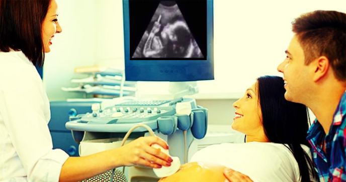 High Quality ultrasound baby FJB Blank Meme Template