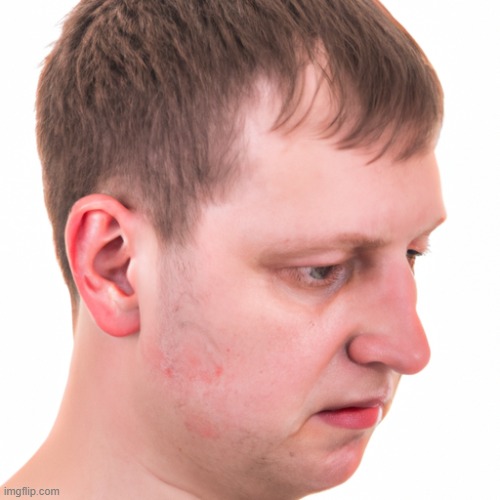 guy with dent in head | image tagged in guy with dent in head | made w/ Imgflip meme maker