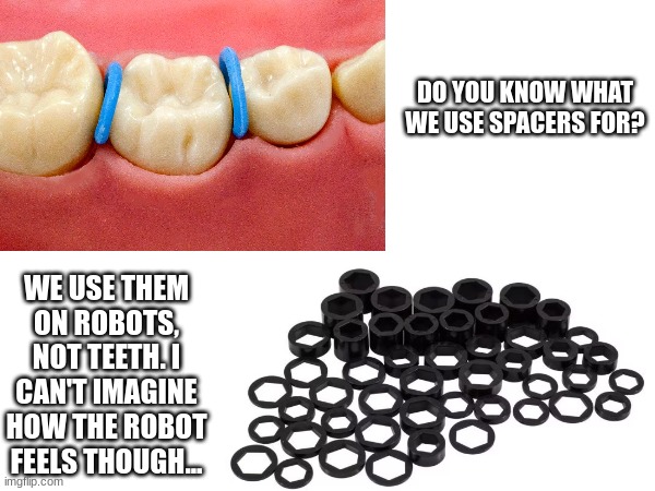Do you feel the same way? | DO YOU KNOW WHAT WE USE SPACERS FOR? WE USE THEM ON ROBOTS, NOT TEETH. I CAN'T IMAGINE HOW THE ROBOT FEELS THOUGH... | image tagged in teeth,robot,space | made w/ Imgflip meme maker