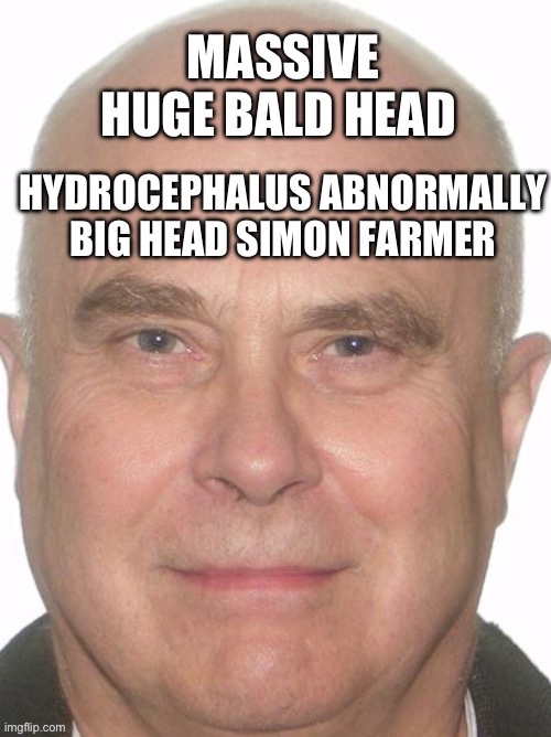 Simon farmer | image tagged in huge,bald,head,big,forehead,ugly | made w/ Imgflip meme maker