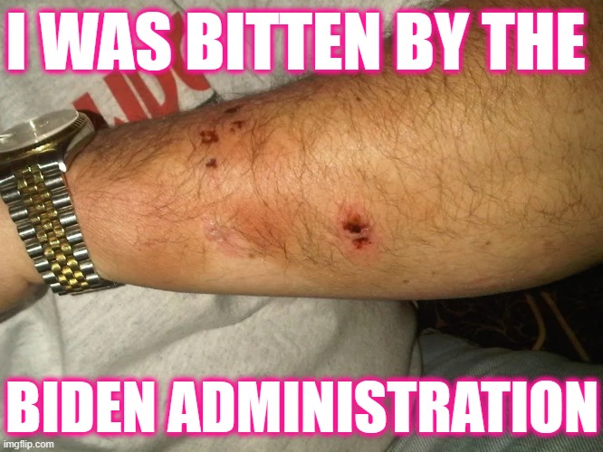 I was bitten by the Biden Administration - dog bite | I WAS BITTEN BY THE; BIDEN ADMINISTRATION | image tagged in gsd german shepherd dog bite jpp,democrat,white house,politics,rescue dogs,pets | made w/ Imgflip meme maker