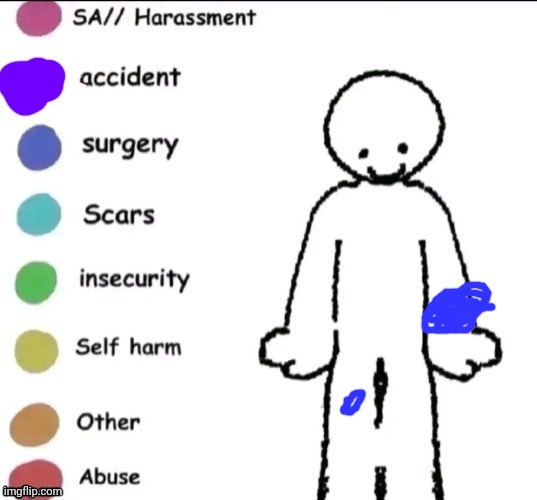 My dumbass broke my wrist in 2019 and badly injured my knee in 2018 | image tagged in pain chart | made w/ Imgflip meme maker