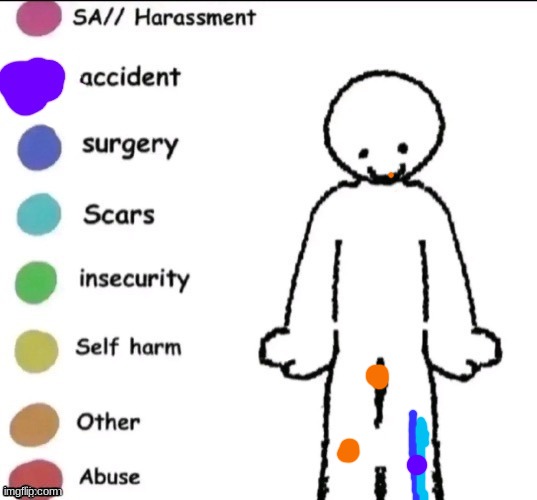 Broke my leg 2 years ago and I have an 8" scar on my left leg...also boxers > boxer briefs | image tagged in pain chart | made w/ Imgflip meme maker