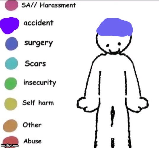 lobotomy ??‍? | image tagged in pain chart | made w/ Imgflip meme maker