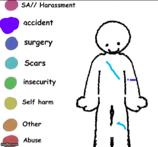 Pain chart | image tagged in pain chart | made w/ Imgflip meme maker
