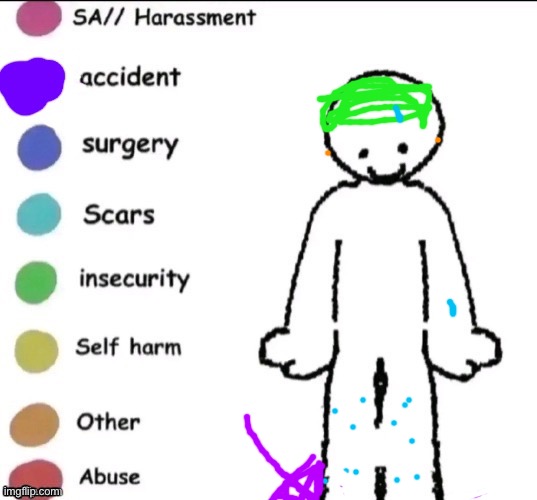 The purple is a *healed* sprain | image tagged in pain,injuries | made w/ Imgflip meme maker