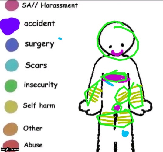 Pain chart | image tagged in pain chart | made w/ Imgflip meme maker