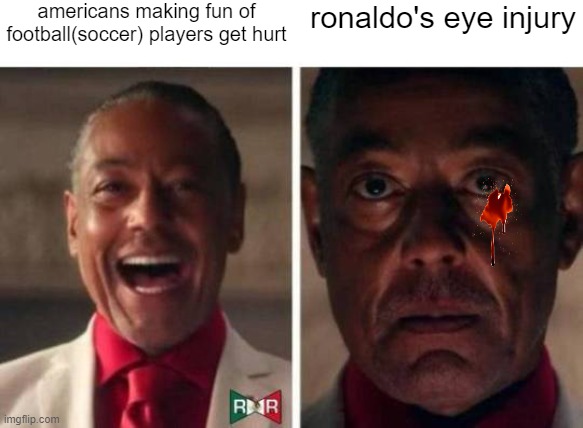 you know you know | americans making fun of football(soccer) players get hurt; ronaldo's eye injury | image tagged in gus fring | made w/ Imgflip meme maker