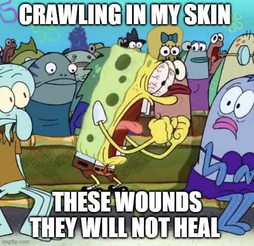 Crawling Linkin Park Spongebob | CRAWLING IN MY SKIN; THESE WOUNDS THEY WILL NOT HEAL | image tagged in spongebob yelling | made w/ Imgflip meme maker