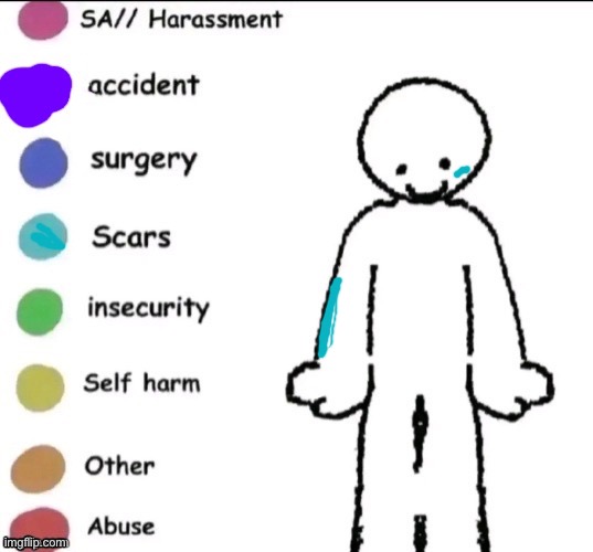 Yeah the arm scar was from a broken fence and the cheek scar is from my sister- | image tagged in pain chart,random | made w/ Imgflip meme maker