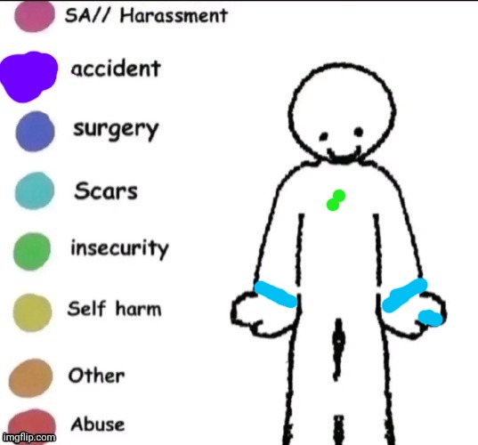 Doing this ig (the scars are my cats clawing me cause they're mean and burns I got from baking) | image tagged in pain chart | made w/ Imgflip meme maker