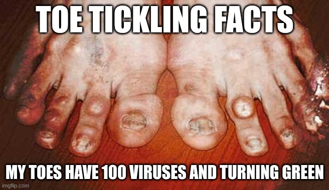 Ugly Feet | TOE TICKLING FACTS; MY TOES HAVE 100 VIRUSES AND TURNING GREEN | image tagged in ugly feet | made w/ Imgflip meme maker