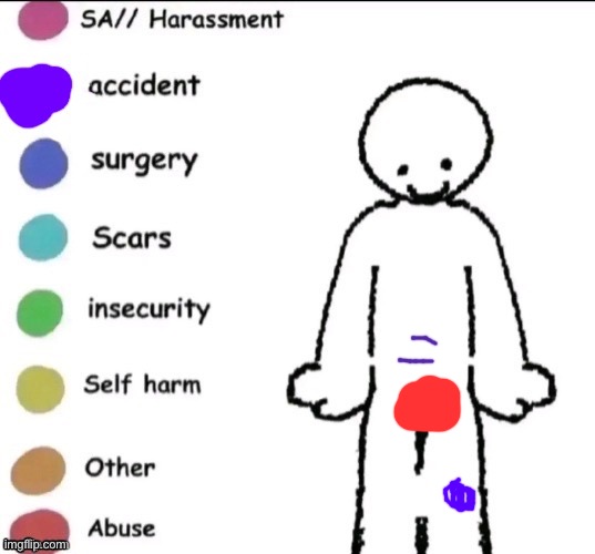 Pain chart | image tagged in pain chart | made w/ Imgflip meme maker