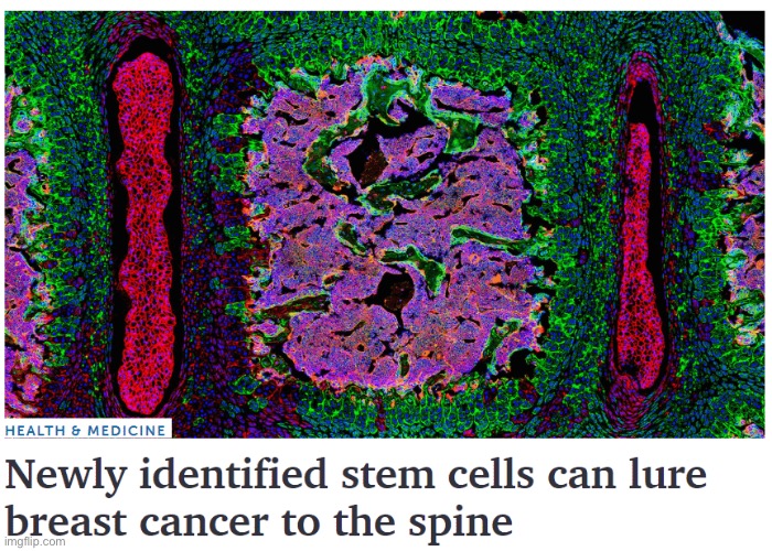 Mildésmallington cells | made w/ Imgflip meme maker