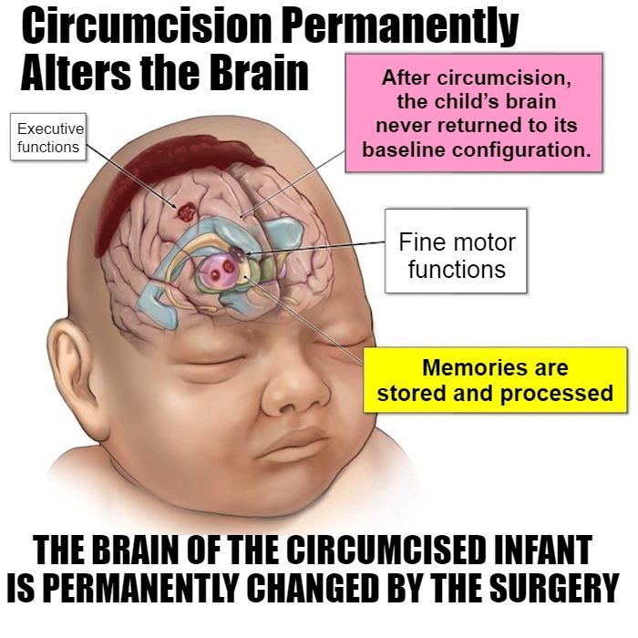 circumcision permanently reprogr (...) Blank Meme Template