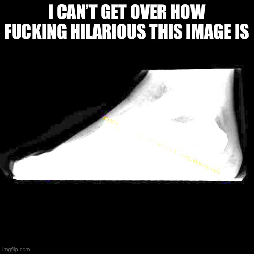Xray | I CAN’T GET OVER HOW FUCKING HILARIOUS THIS IMAGE IS | made w/ Imgflip meme maker