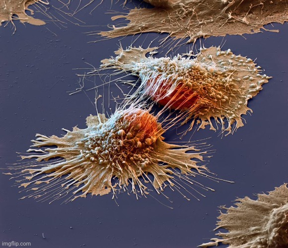 cancer cell under a microscope | image tagged in cancer cell under a microscope | made w/ Imgflip meme maker