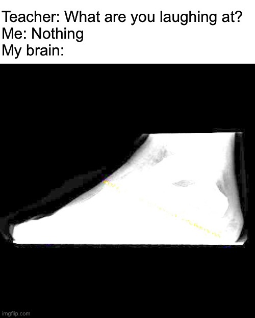 *microwave noises* | Teacher: What are you laughing at?
Me: Nothing
My brain: | image tagged in xray,x-ray | made w/ Imgflip meme maker