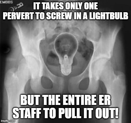 Bulb Pervert | IT TAKES ONLY ONE PERVERT TO SCREW IN A LIGHTBULB; BUT THE ENTIRE ER STAFF TO PULL IT OUT! | image tagged in lightbulb in bum | made w/ Imgflip meme maker