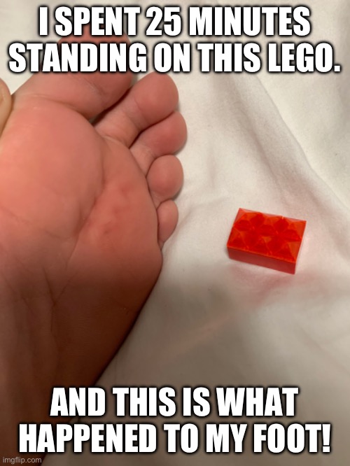 I am still in pain! | I SPENT 25 MINUTES STANDING ON THIS LEGO. AND THIS IS WHAT HAPPENED TO MY FOOT! | image tagged in lego,pain | made w/ Imgflip meme maker