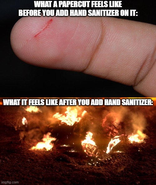 WHAT A PAPERCUT FEELS LIKE BEFORE YOU ADD HAND SANITIZER ON IT:; WHAT IT FEELS LIKE AFTER YOU ADD HAND SANITIZER: | image tagged in burning anakin | made w/ Imgflip meme maker