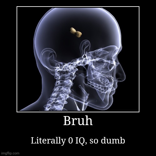 Bruh | Literally 0 IQ, so dumb | image tagged in funny,demotivationals | made w/ Imgflip demotivational maker