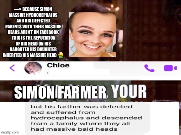 Simon Farmers Ugly Genetically Bald Massive Head Produced this ugly cunt ??? | image tagged in ugly girl,ugly,daughter,ugly face,big head,forehead | made w/ Imgflip meme maker