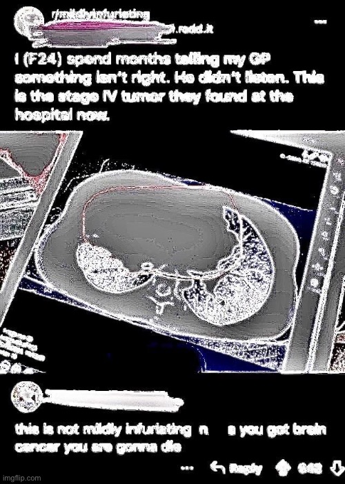 Mildésmallington tumor | made w/ Imgflip meme maker