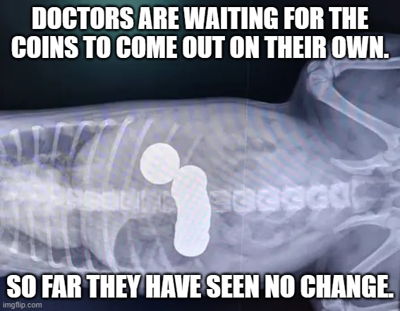 meme by Brad coins in stomach | DOCTORS ARE WAITING FOR THE COINS TO COME OUT ON THEIR OWN. SO FAR THEY HAVE SEEN NO CHANGE. | image tagged in health | made w/ Imgflip meme maker