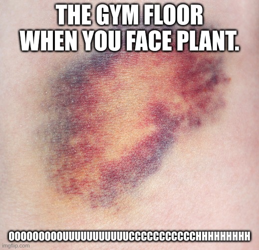 brusie | THE GYM FLOOR WHEN YOU FACE PLANT. OOOOOOOOOUUUUUUUUUUUCCCCCCCCCCCHHHHHHHHH | image tagged in injuries | made w/ Imgflip meme maker