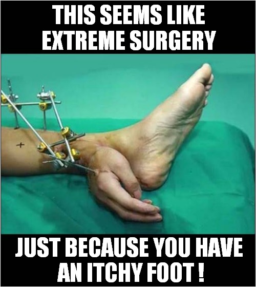 Mad Doctor At Work ! | THIS SEEMS LIKE
EXTREME SURGERY; JUST BECAUSE YOU HAVE
 AN ITCHY FOOT ! | image tagged in doctor,surgery,dark humour | made w/ Imgflip meme maker