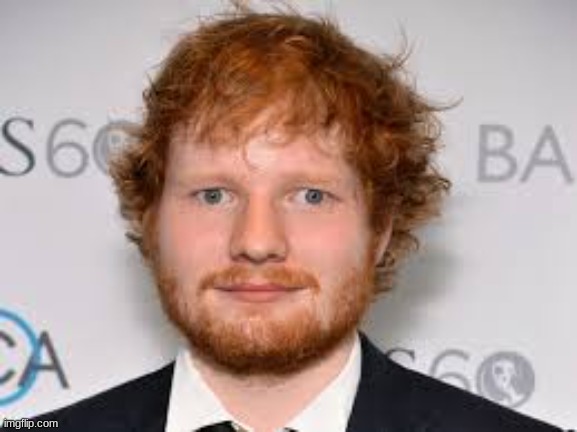 Derpy Ed Sheeran | image tagged in derpy ed sheeran | made w/ Imgflip meme maker