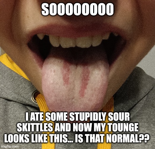 How?? | SOOOOOOOO; I ATE SOME STUPIDLY SOUR SKITTLES AND NOW MY TOUNGE LOOKS LIKE THIS... IS THAT NORMAL?? | image tagged in question | made w/ Imgflip meme maker