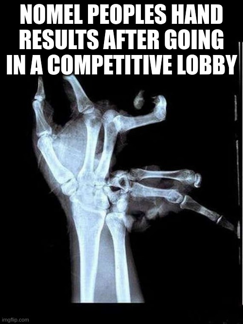 gorilla tag | NOMEL PEOPLES HAND RESULTS AFTER GOING IN A COMPETITIVE LOBBY | image tagged in broken hand | made w/ Imgflip meme maker