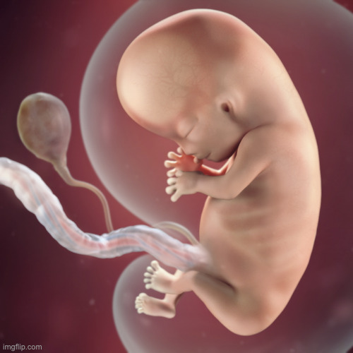 10 Week Fetus | image tagged in 10 week fetus | made w/ Imgflip meme maker