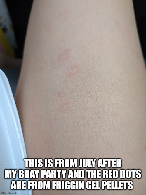 :) | THIS IS FROM JULY AFTER MY BDAY PARTY AND THE RED DOTS ARE FROM FRIGGIN GEL PELLETS | image tagged in slayer | made w/ Imgflip meme maker
