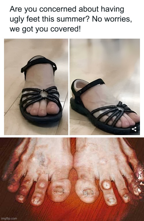 Would you rather have ugly feet or wear only feet shoes for the rest of your life | image tagged in ugly feet,feet,shoes,clown shoes,would you rather,cursed | made w/ Imgflip meme maker