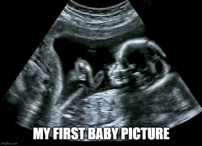 Me as a child | MY FIRST BABY PICTURE | image tagged in abortion,abortion is murder,human rights,fetus,birth,pregnancy | made w/ Imgflip meme maker