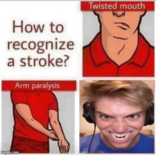 How to recognize a stroke | image tagged in how to recognize a stroke | made w/ Imgflip meme maker