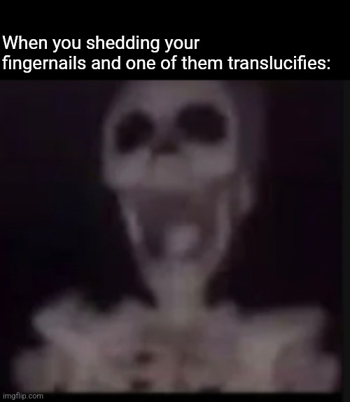screaming skeleton | When you shedding your fingernails and one of them translucifies: | image tagged in screaming skeleton | made w/ Imgflip meme maker