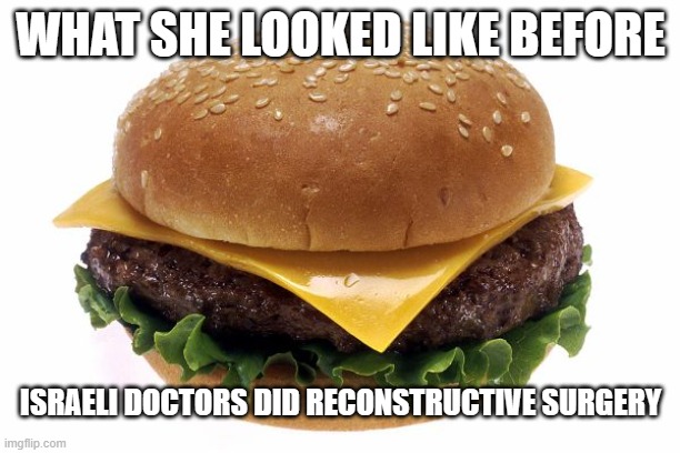 Burger | WHAT SHE LOOKED LIKE BEFORE ISRAELI DOCTORS DID RECONSTRUCTIVE SURGERY | image tagged in burger | made w/ Imgflip meme maker