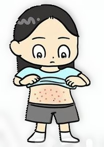 girl with eczema Blank Meme Template